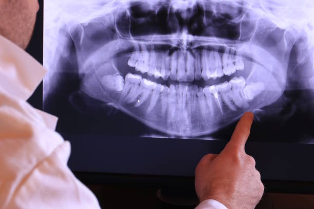 Best Emergency Gum Pain Relief  in Woodmere, LA
